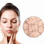 P&eacute;rdida de apetito cuando nos enamoramos, &iquest;por qu&eacute; sucede?: circulo zoom muestra piel facial seca antes humedecer chica joven retrato belleza cerca 99433 690 150x150 - HeelEspa&ntilde;a