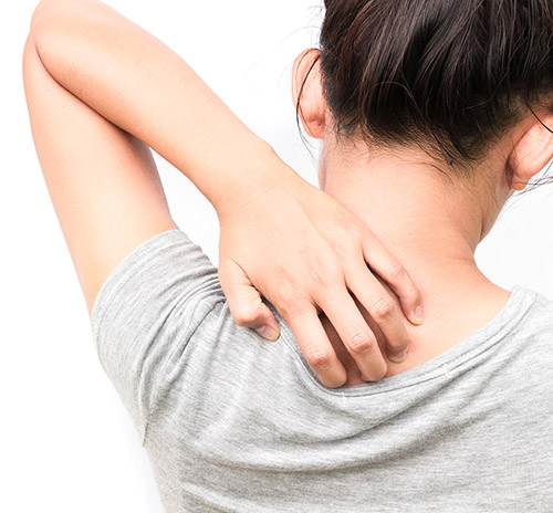 Qué es la dermatitis atópica, sus síntoma y nuevos tratamientos - HeelProbiotics - HeelEspaña