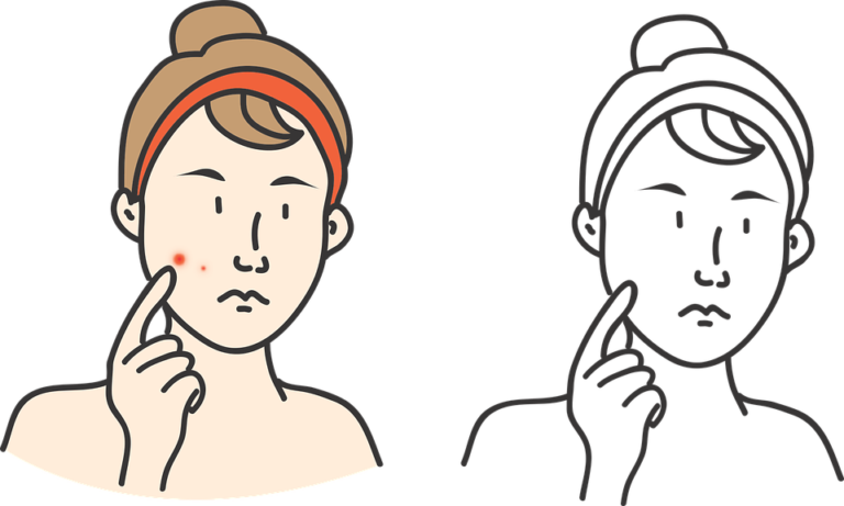 ¿Sabes la diferencia entre dermatitis y psoriasis? - HeelEspaña