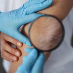 &iquest;C&oacute;mo hidratar la piel de forma natural?: senales piel 150x150 - HeelEspa&ntilde;a