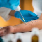 &iquest;Por qu&eacute; tengo picor en la nariz?: reacciones alergicas otono 150x150 - HeelEspa&ntilde;a