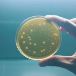 S&iacute;ndrome del intestino permeable y el desequilibrio en el sistema inmune: microorganismos2 150x150 - HeelEspa&ntilde;a