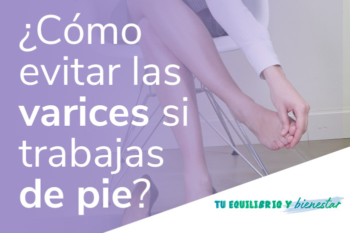 Varices si trabajas de pie