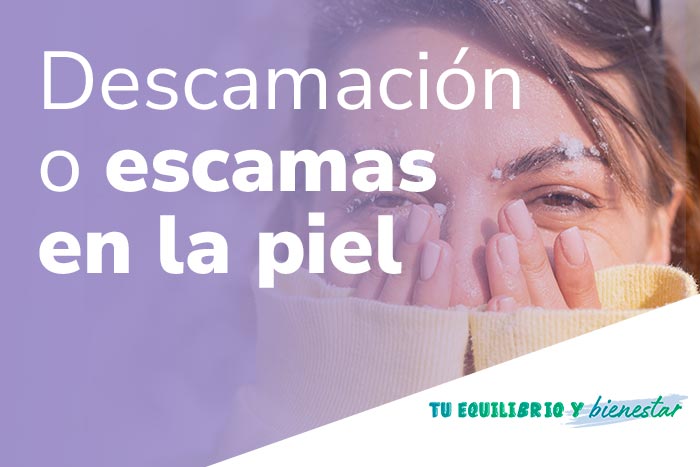 Escamas en la piel o descamación en la piel, ¿qué es lo que tengo?