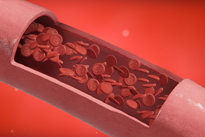 Cómo mejorar la microcirculación