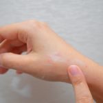 Dieta y microbiota intestinal: la relaci&oacute;n que no conoc&iacute;as: microbiota dermatitis atopica 150x150 - HeelEspa&ntilde;a